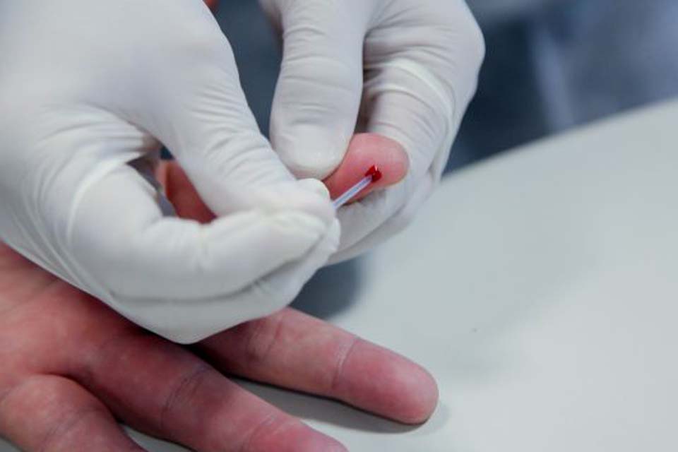  Testagem rápida para moradores do Setor Chacareiro de Porto Velho ocorre neste domingo