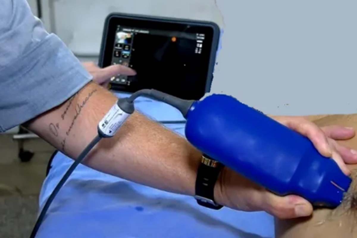 Equipamentos com tecnologia de IA agilizam exames no Pronto-Socorro João Paulo II, em Porto Velho