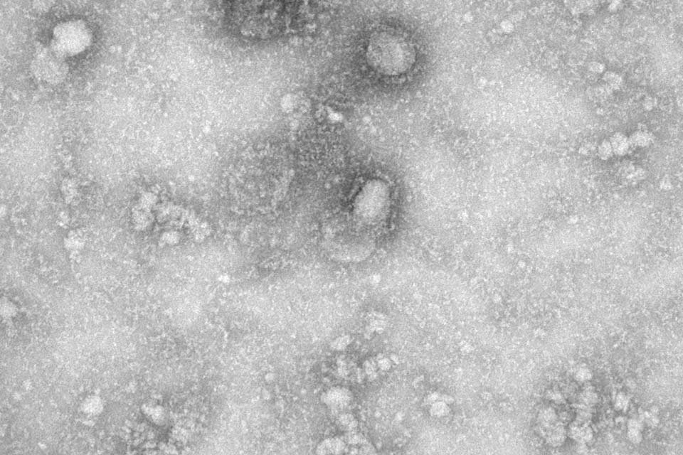 China adota novas medidas para lidar com coronavírus