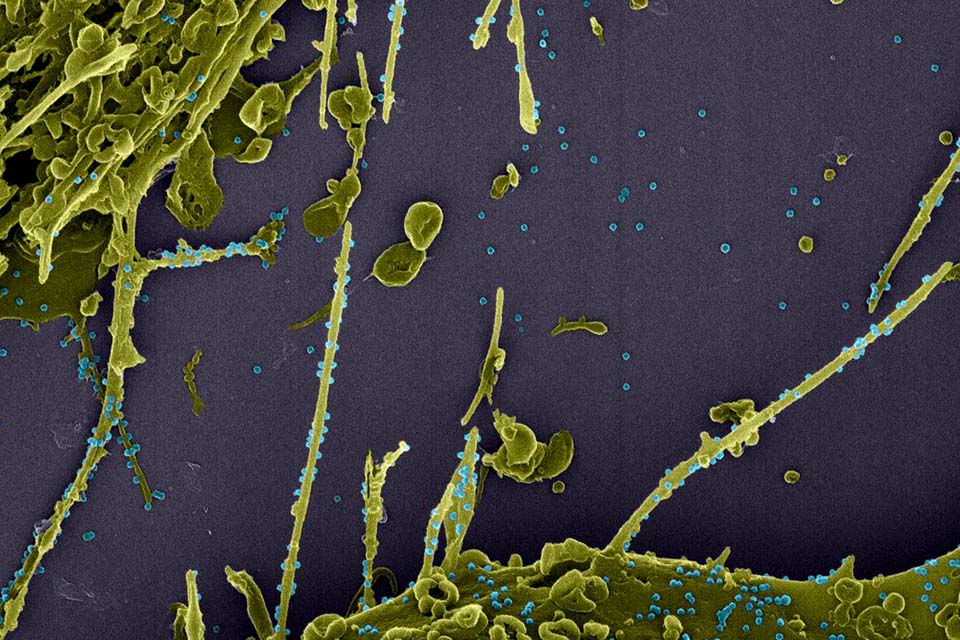 Argentina, Colômbia, Chile e Peru suspendem voos com o Reino Unido