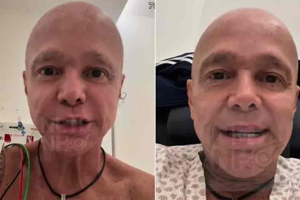 Netinho sobre etapa do tratamento contra câncer: “Minha barriga está uma peneira”