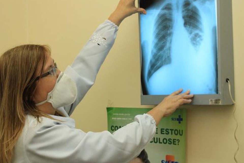 Brasil instala comitê interministerial para eliminação da tuberculose 