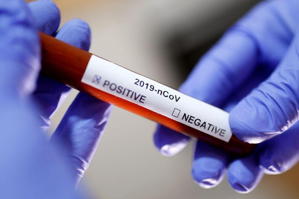 Secretaria Municipal de Saúde compra testes rápidos de covid-19 para acelerar diagnóstico na cidade