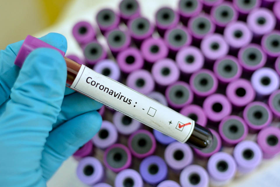 Rondônia permanece com nove casos confirmados de coronavírus