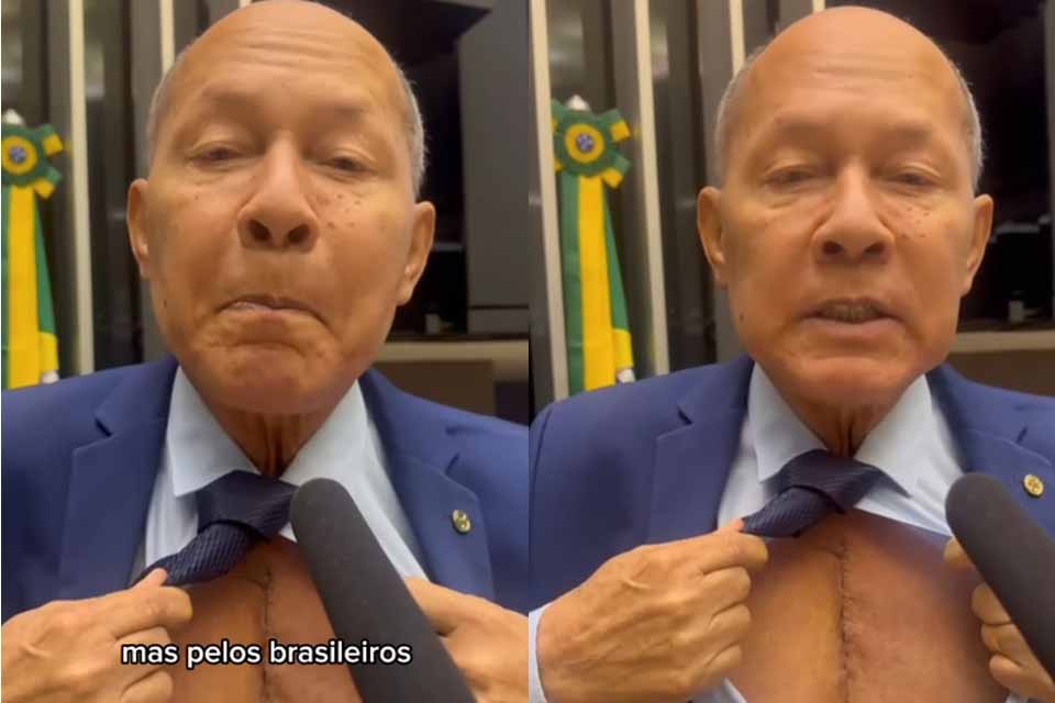“Abri o coração há uma semana”: Coronel Chrisóstomo exibe cicatriz e se junta a protesto no Congresso após prisão de Bolsonaro
