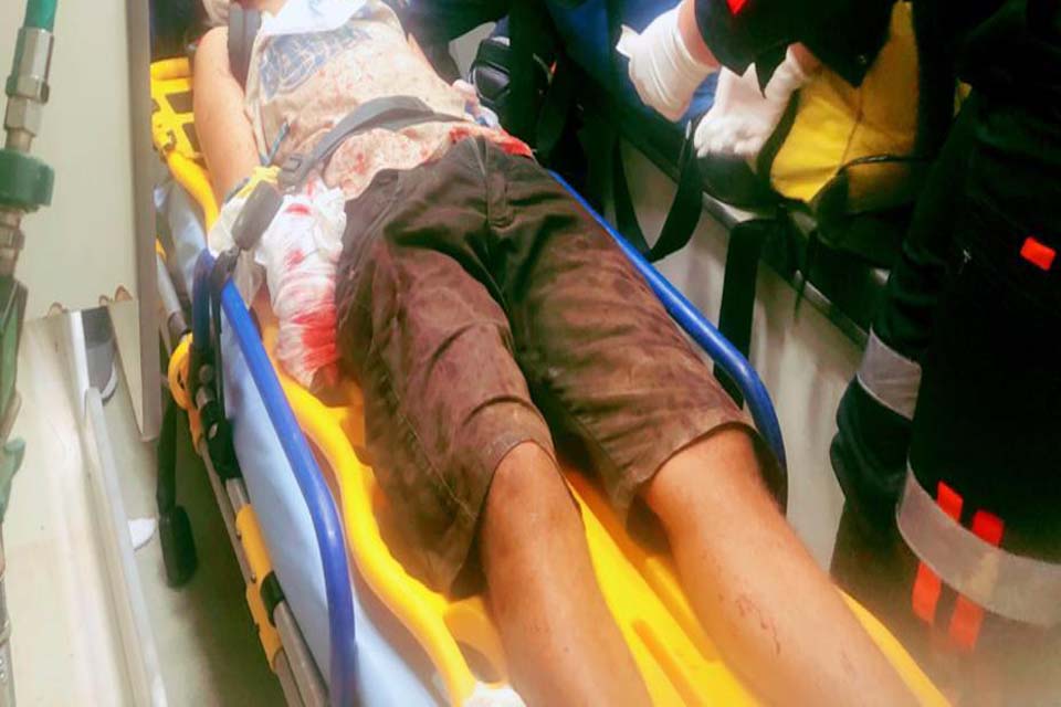 Jovem tem o braço quase decepado após ser atacado com golpes de facão