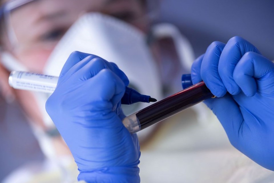 Estado de SP tem mais de 393 mil casos confirmados de covid-19