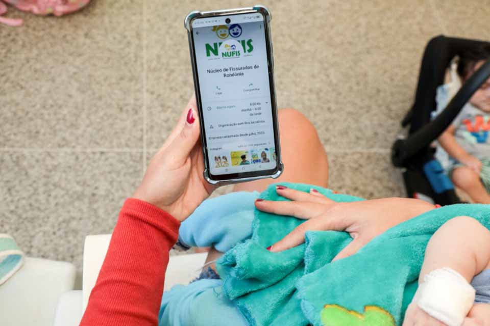 Governo de Rondônia transforma vidas no estado com mais de 24 mil consultas e 317 cirurgias de fissura labiopalatina