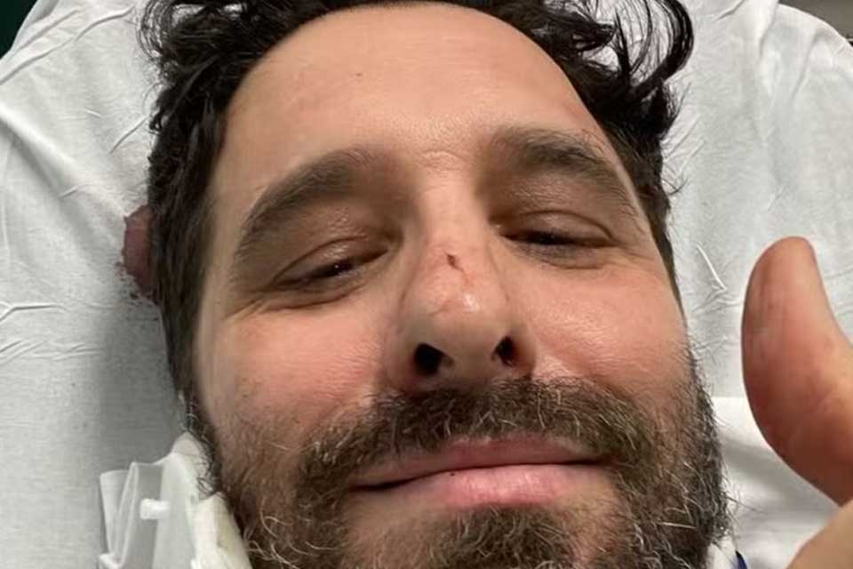 “Apaguei no meio da rua”, diz Rafinha Bastos após acidente em Nova York