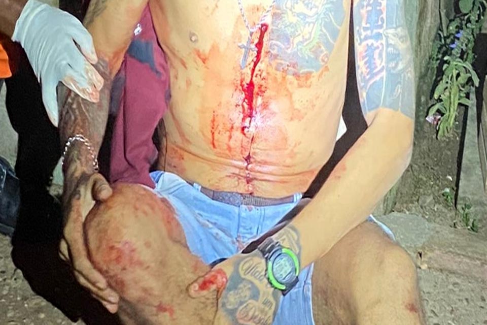 Ex-presidiário é alvejado com vários tiros no 2° Distrito de Ji-Paraná