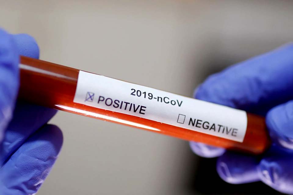 Em SP, casos confirmados de coronavírus sobem 38% em um dia