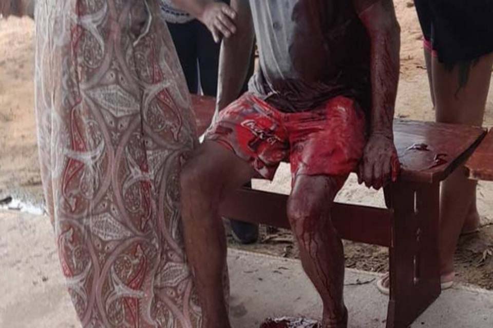 Homem é atacado com cinco facadas em Pimenteiras do Oeste