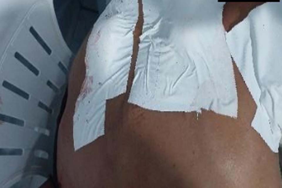 Homem é atacado a golpes de canivete durante bebedeira na zona rural