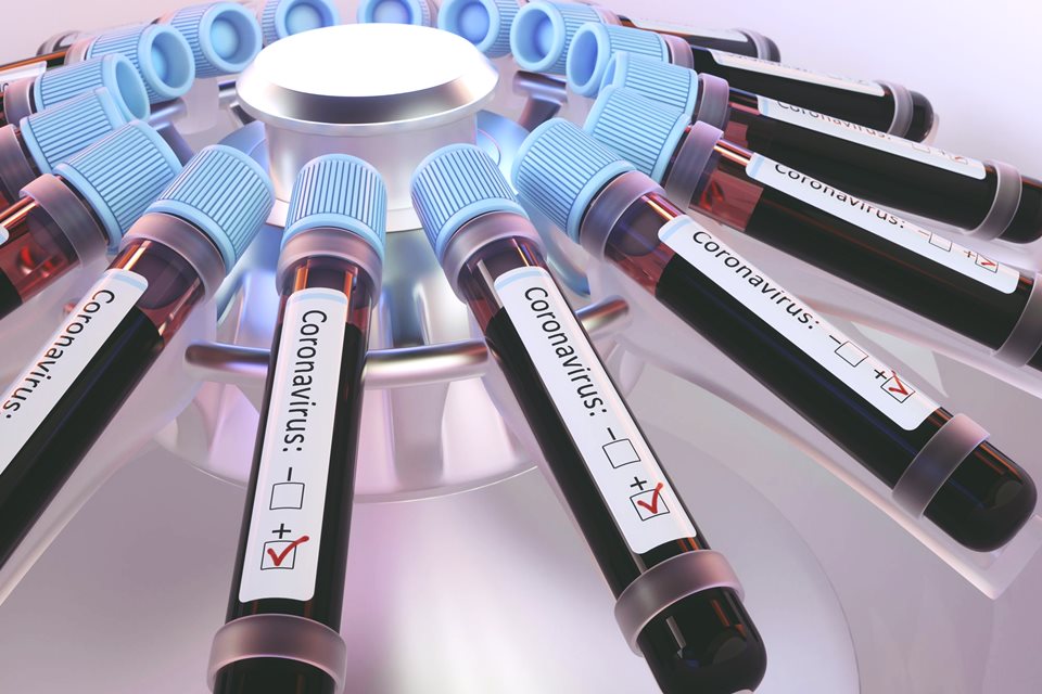 São Paulo tem mais 224 mortes por coronavírus em 24 horas