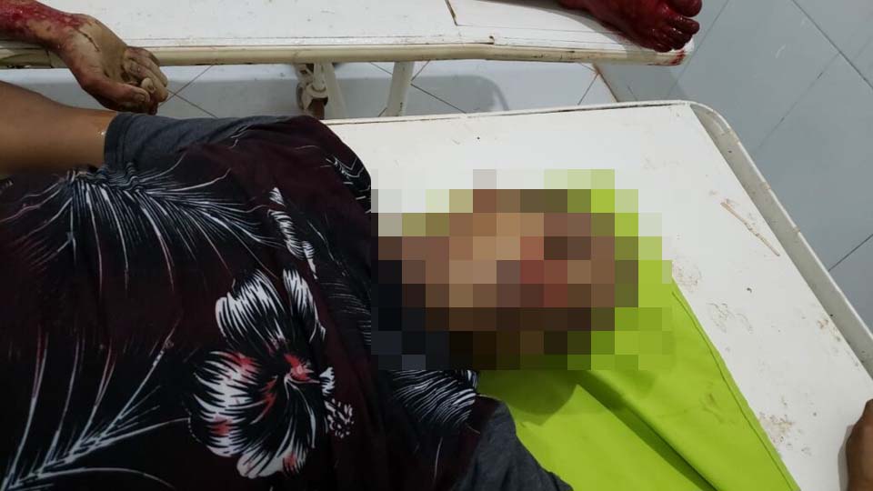 Suposto Membro do CV morto em confronto com a Polícia do Pará