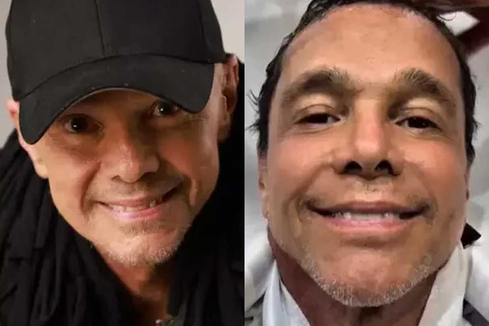 “Meu cabelo voltou a crescer”, comemora Netinho após tratamento contra câncer