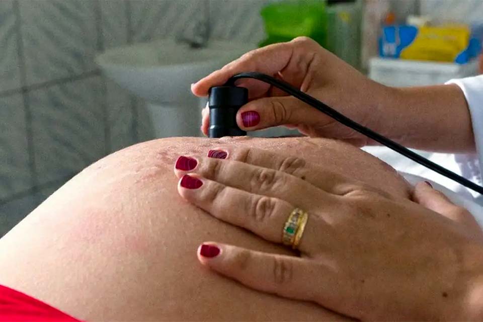 Teste para HTLV passa a ser indicado para gestantes durante pré-natal