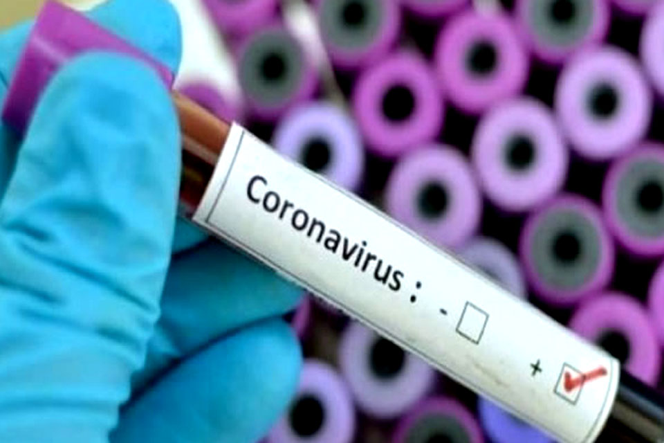 Nota Oficial: Município confirma segundo caso positivo para covid-19; trata-se de uma mulher de 35 anos