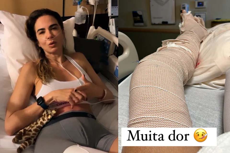 Luciana Gimenez grava vídeo após acidente na neve: 'Quebrei minha perna em quatro lugares'