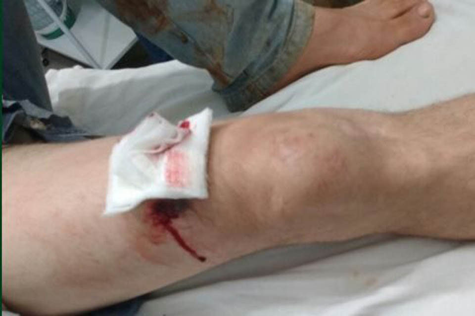 Mototaxi é baleado durante roubo na zona leste de Porto Velho