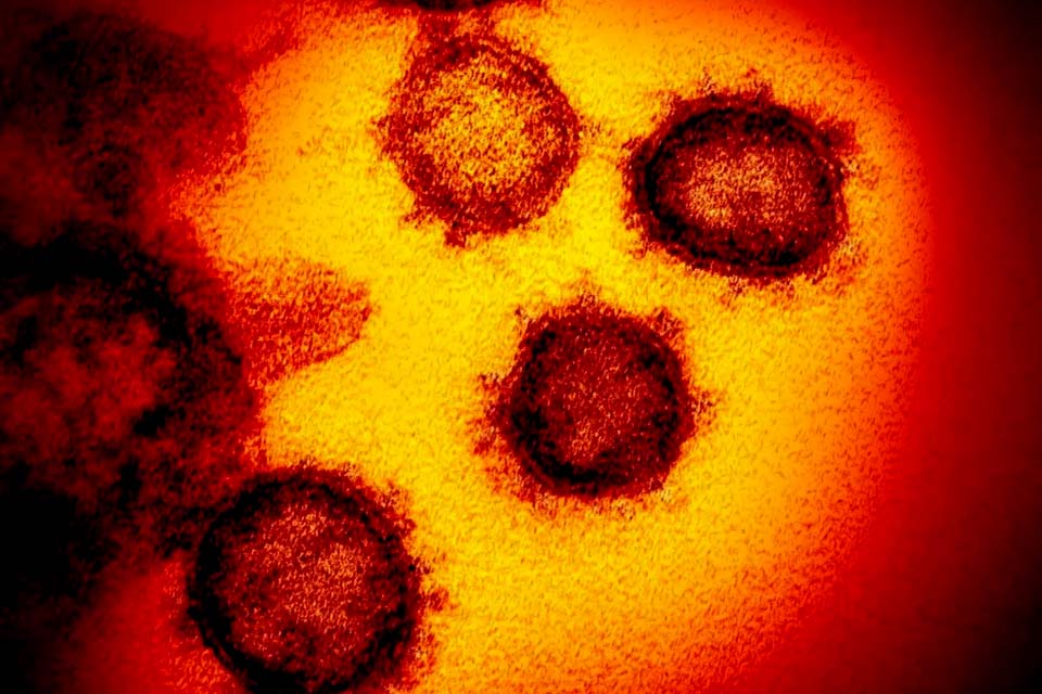 Em teste inicial, vacina chinesa contra a Covid-19 tem resultados seguros e induz resposta imunológica