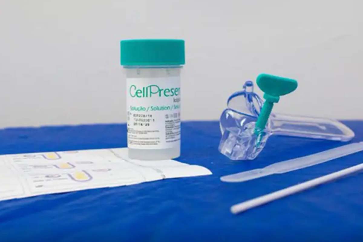 SUS detecta quase 10 mil testes positivos para HPV de alto risco