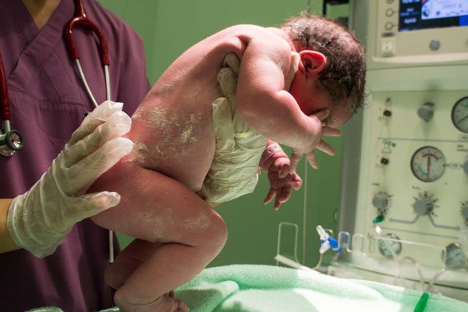Acordo proposto pelo MP prevê capacitação em reanimação neonatal em Hospital 