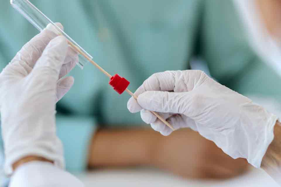 Do HIV à glicemia: conheça os principais tipos de testes rápidos existentes