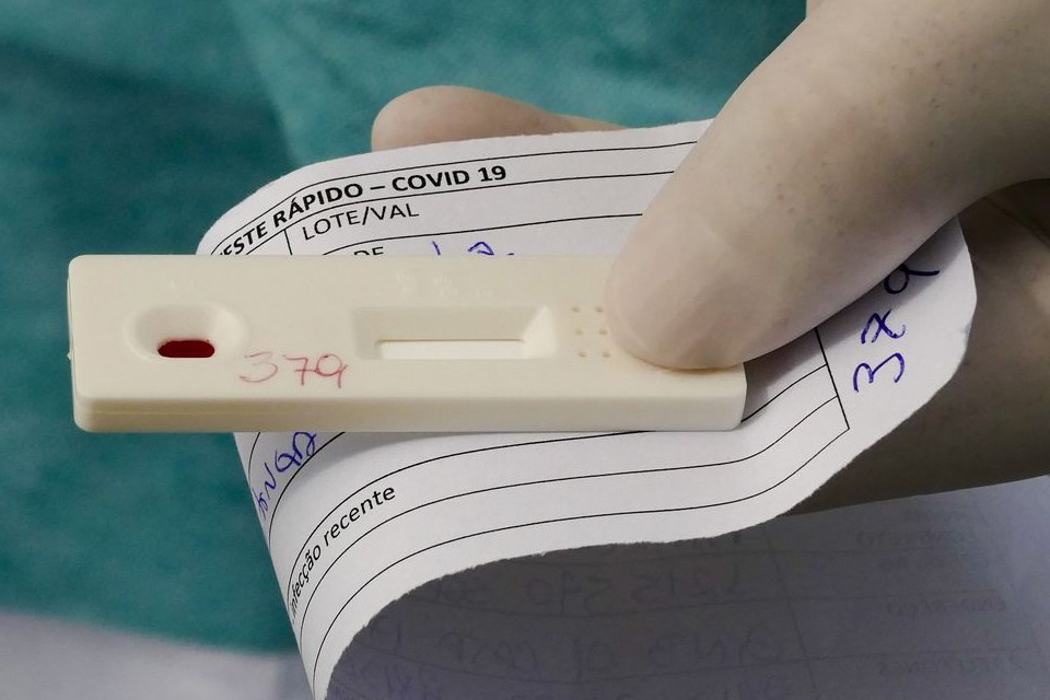 ANS decide se testes para covid-19 continuam obrigatórios
