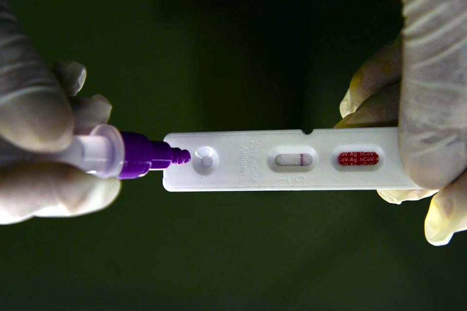 Hospitalizações por covid-19 mantêm tendência de alta nos estados