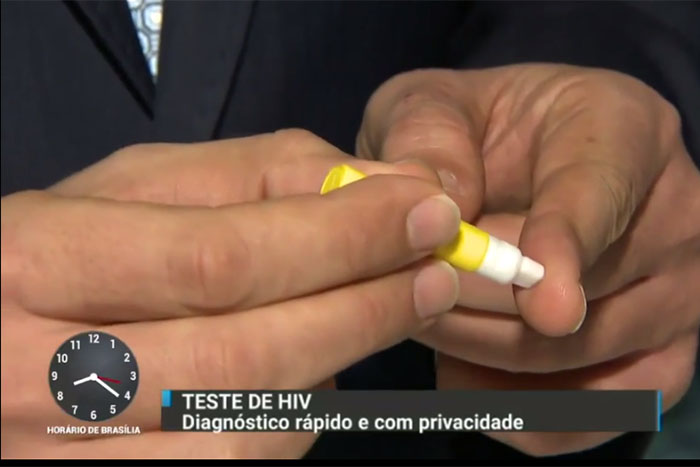 Novo teste de HIV mostra o resultado em 20 minutos