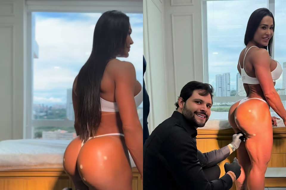 Gracyanne Barbosa exibe bumbum após harmonização glútea