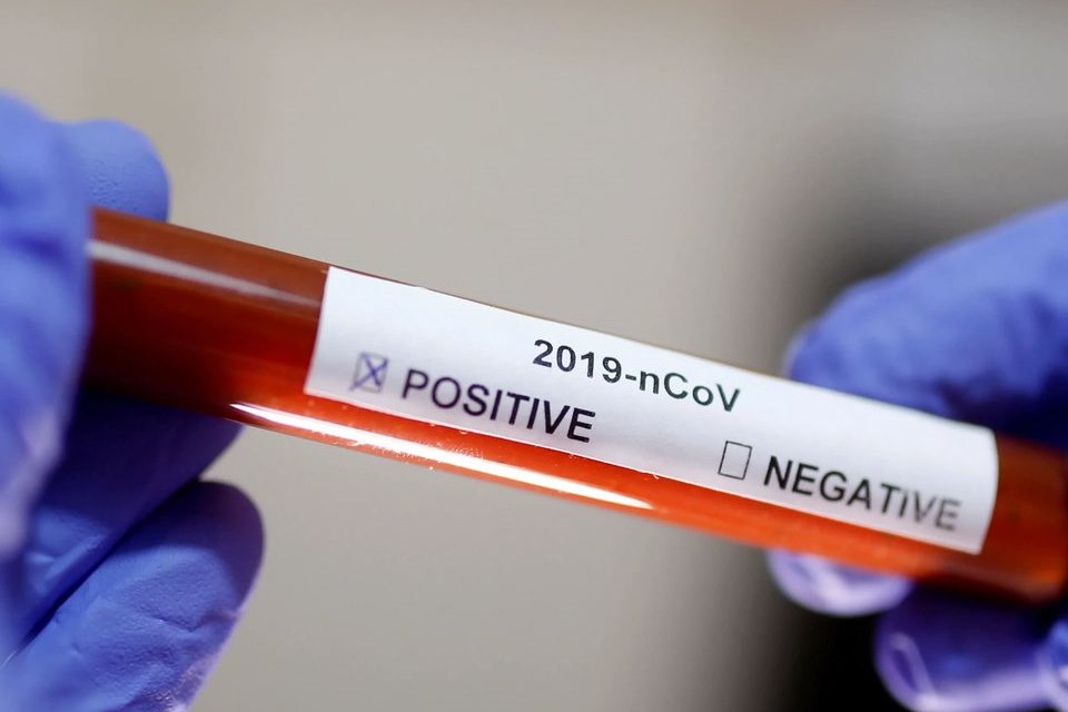 Paraguai registra 1ª morte por novo coronavírus em mais de um mês