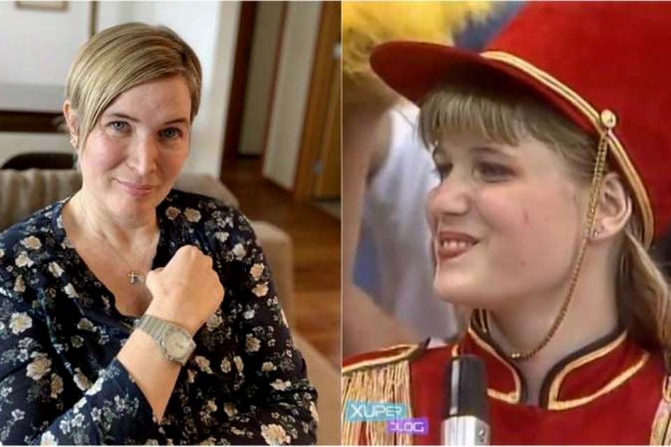 Em luta contra esclerose múltipla, ex-paquita fala em “superação”