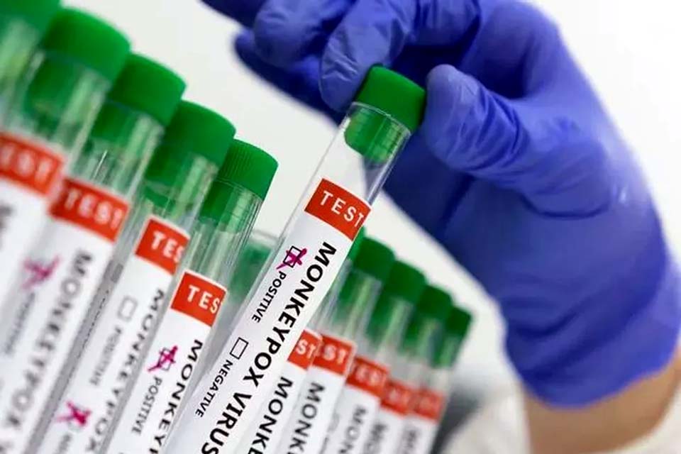  Ministério da Saúde amplia testagem de varíola dos macacos