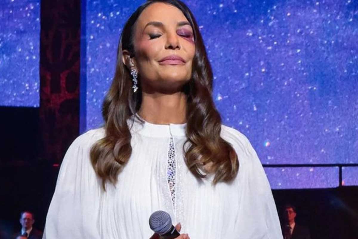 Ivete Sangalo enfrenta cirurgia de quase 7 horas para corrigir fratura no maxilar