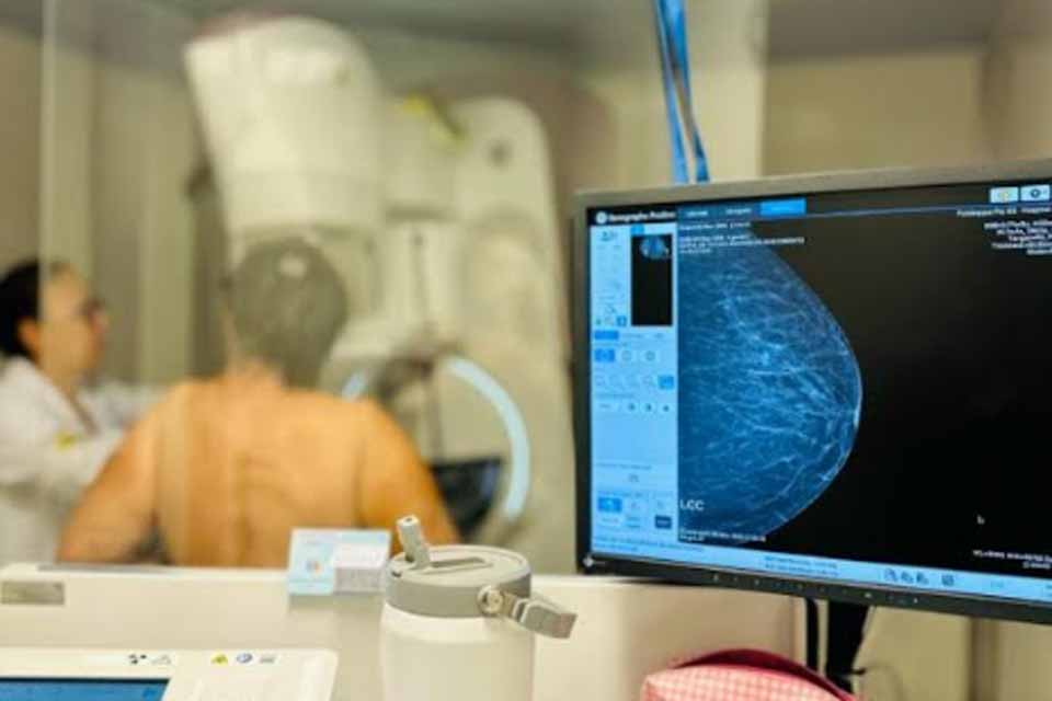 Inscrições para exames feitos pela Carreta do Hospital de Amor começam na próxima segunda-feira (09)