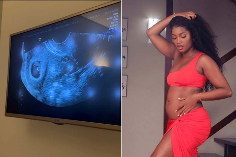 Iza encanta as redes sociais após mostrar imagens de sua primeira ultrassom