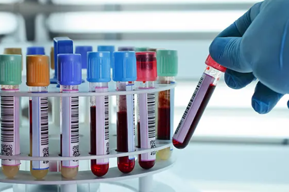 Exames laboratoriais são ofertados na sede do SINPRO-RO