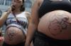 Fatores sociais e estruturais empurram mulheres para cesarianas