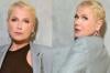 Xuxa mostra resultado de transplante capilar e fala sobre luta contra alopecia
