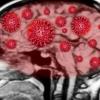 Estudo aponta sequelas neurológicas em pacientes leves de covid-19