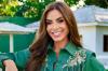 Nicole Bahls fala sobre diagnóstico de alopecia e ajuda de Anitta