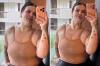 “Estava me impedindo de viver”, relata Thais Carla após perder 85 kg