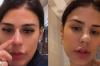 Simone Mendes nega cirurgia ao aparecer com nariz diferente