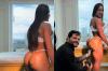 Gracyanne Barbosa exibe bumbum após harmonização glútea