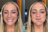 Filha de Heloisa Périssé assusta seguidores ao mostrar princípio de paralisia facial