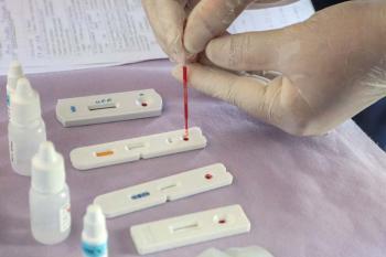 Estudo inédito da Fiocruz pode ampliar prevenção de HIV entre jovens