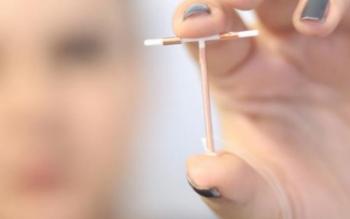 Superávit primário do Governo Central fica em R$ 86,9 bilhões