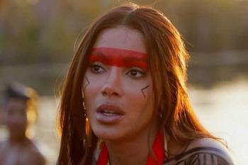 “Porque eu tava a fim!”: Anitta reage a críticas sobre procedimentos estéticos